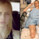 American model loses legs and almost dies despite proper tampo